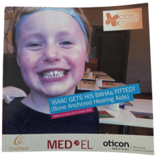 Isaac Gets His BAHAs Fitted