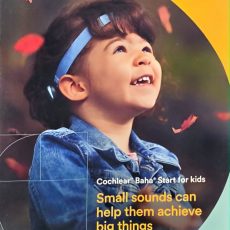 Cochlear Information